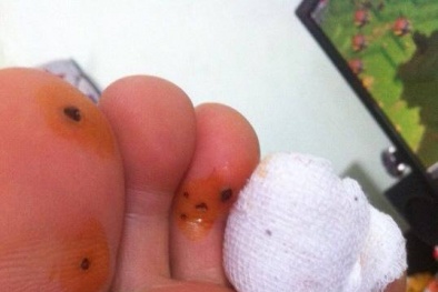 Thối chân vì lót giầy thơm Trung Quốc